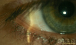 /1_VAA/1_Tf/LIPCOF/TF(Lipcof)_4.jpg