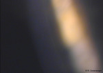 /1_VAA/5_HH/Stroma/55_Nervenfaser.jpg