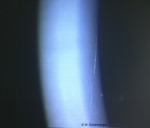 /1_VAA/5_HH/Stroma/55_STRIAE.jpg