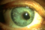 /1_VAA/7_Iris/7(3).jpg